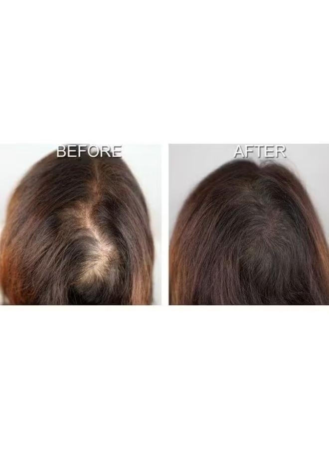 Faster Hair Back Black Garlic Advanced 100 Ml Red - Image 5